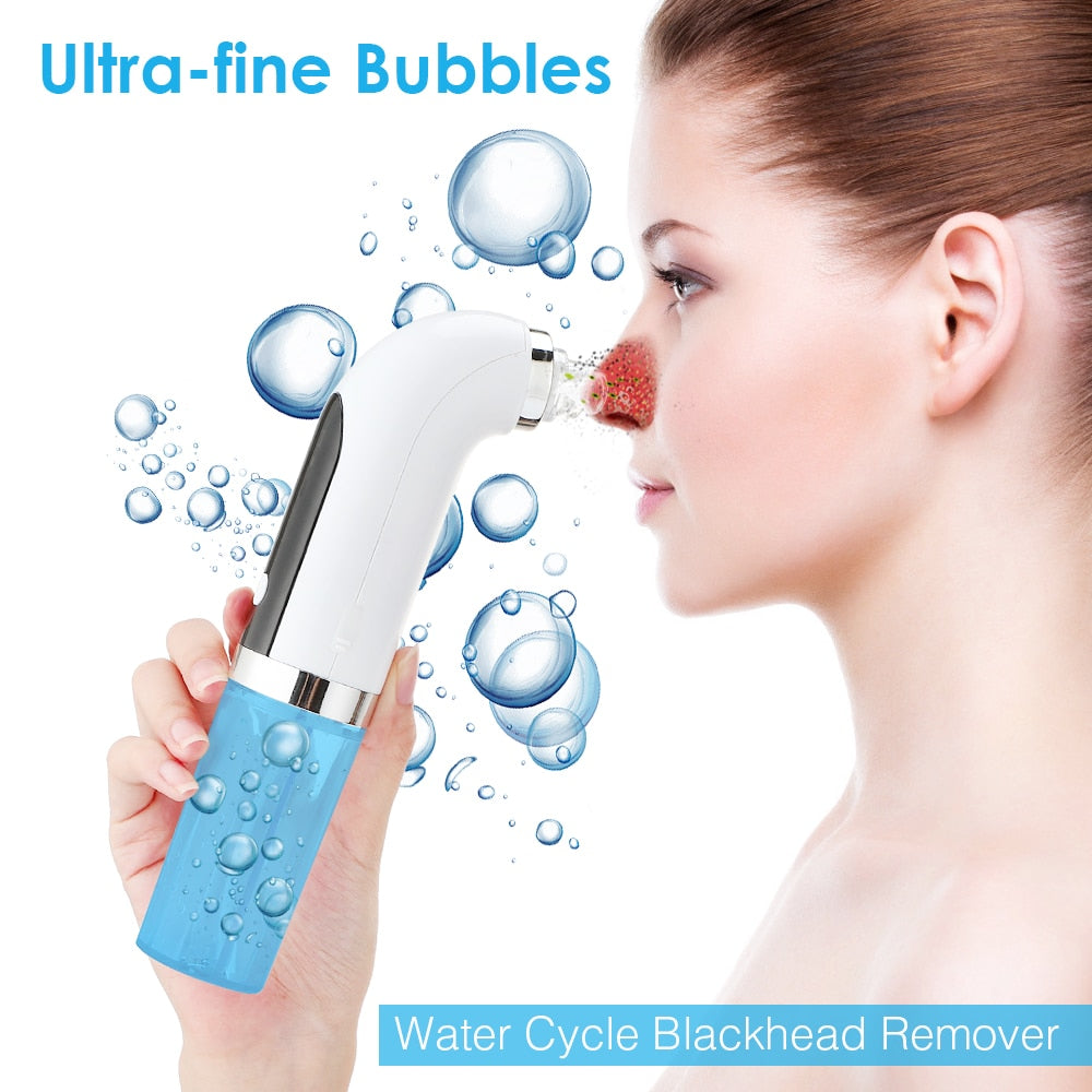 Electric Blackhead Remover - myatozmall