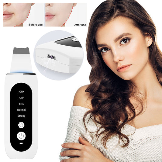 Ultrasonic Skin Exfoliator Scraper - myatozmall